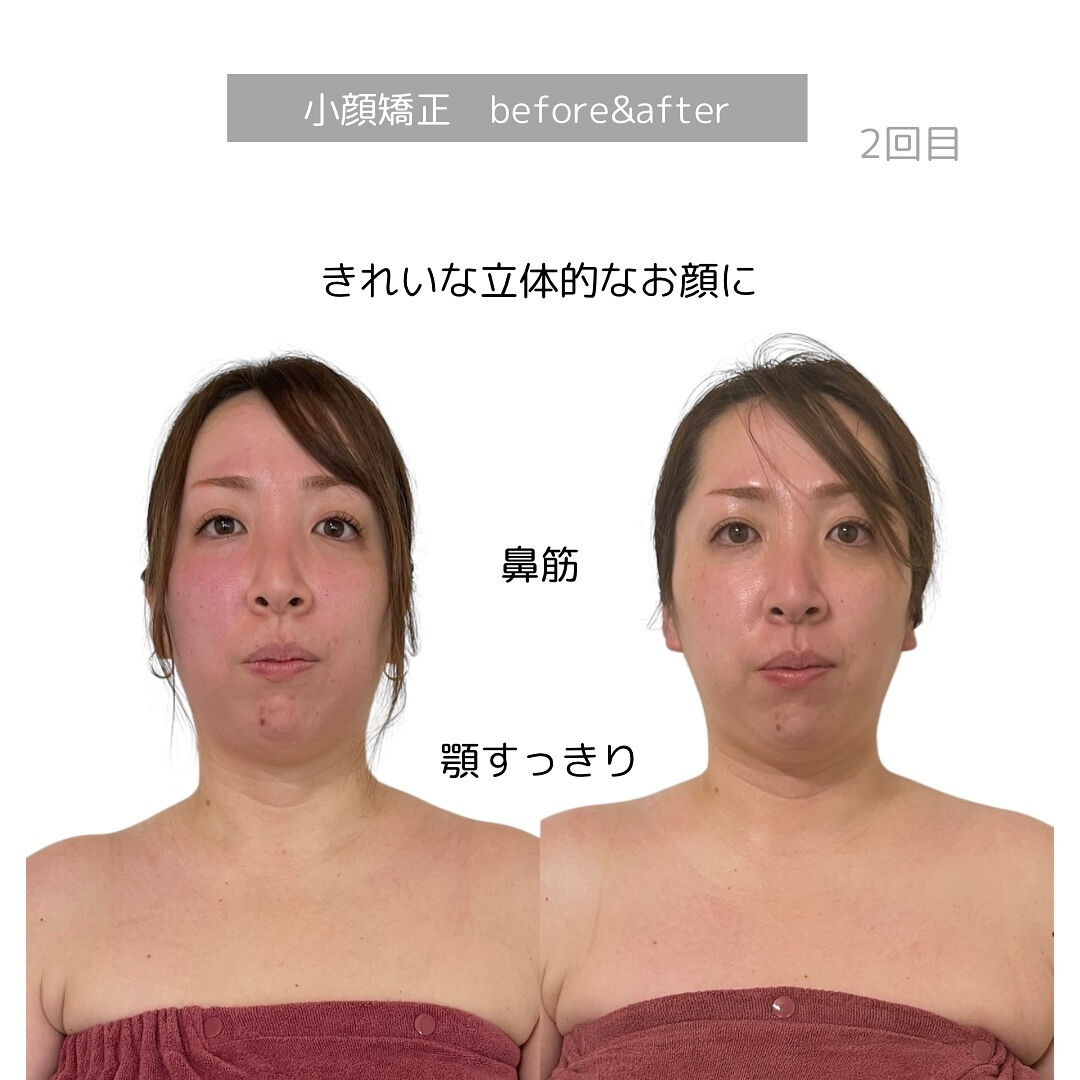 お顔の立体感！