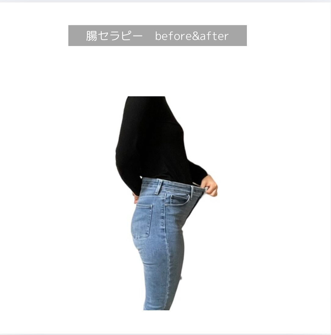腸セラピー