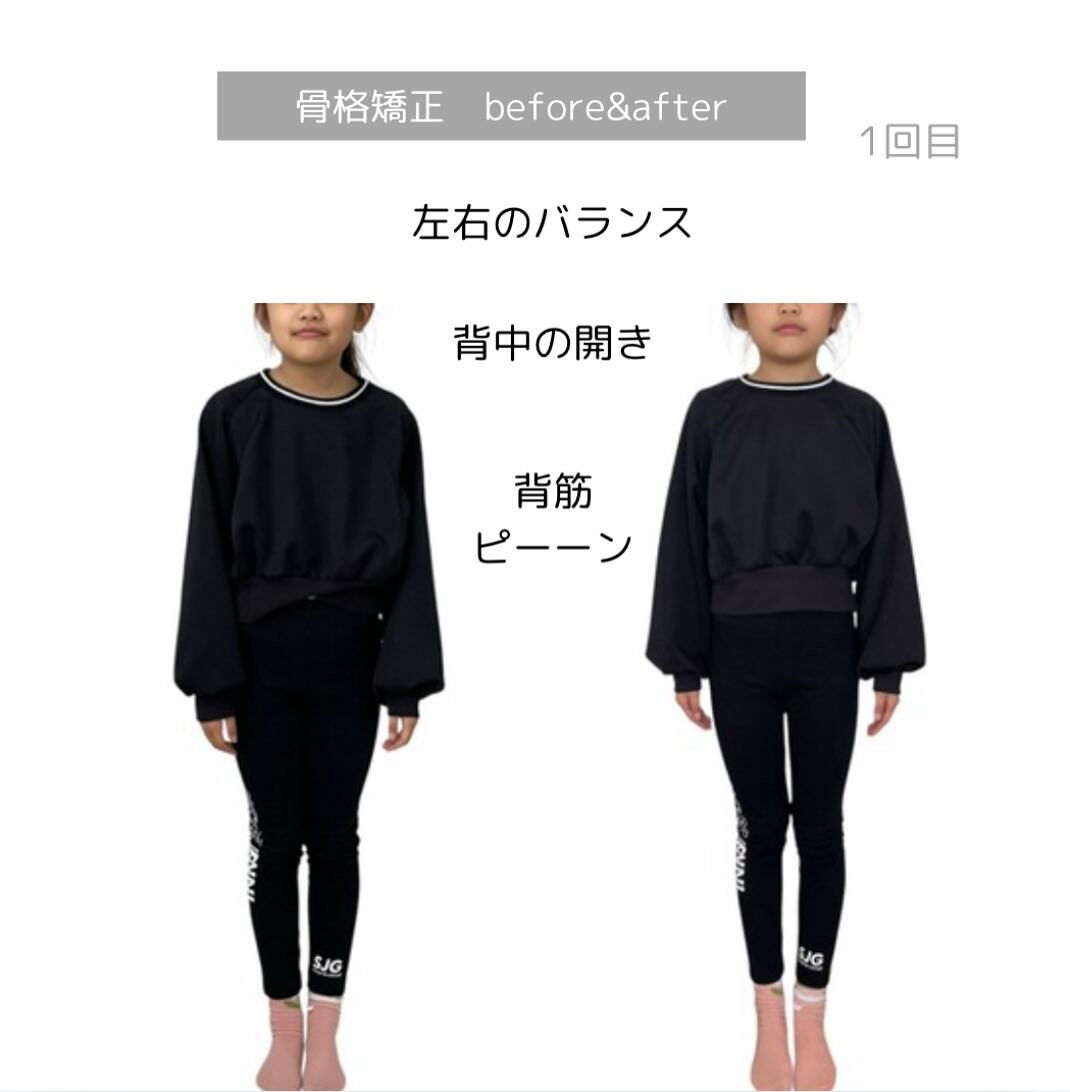 骨格矯正キッズver.