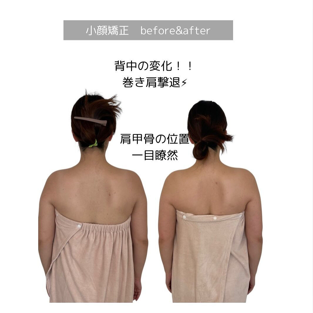 巻き肩…