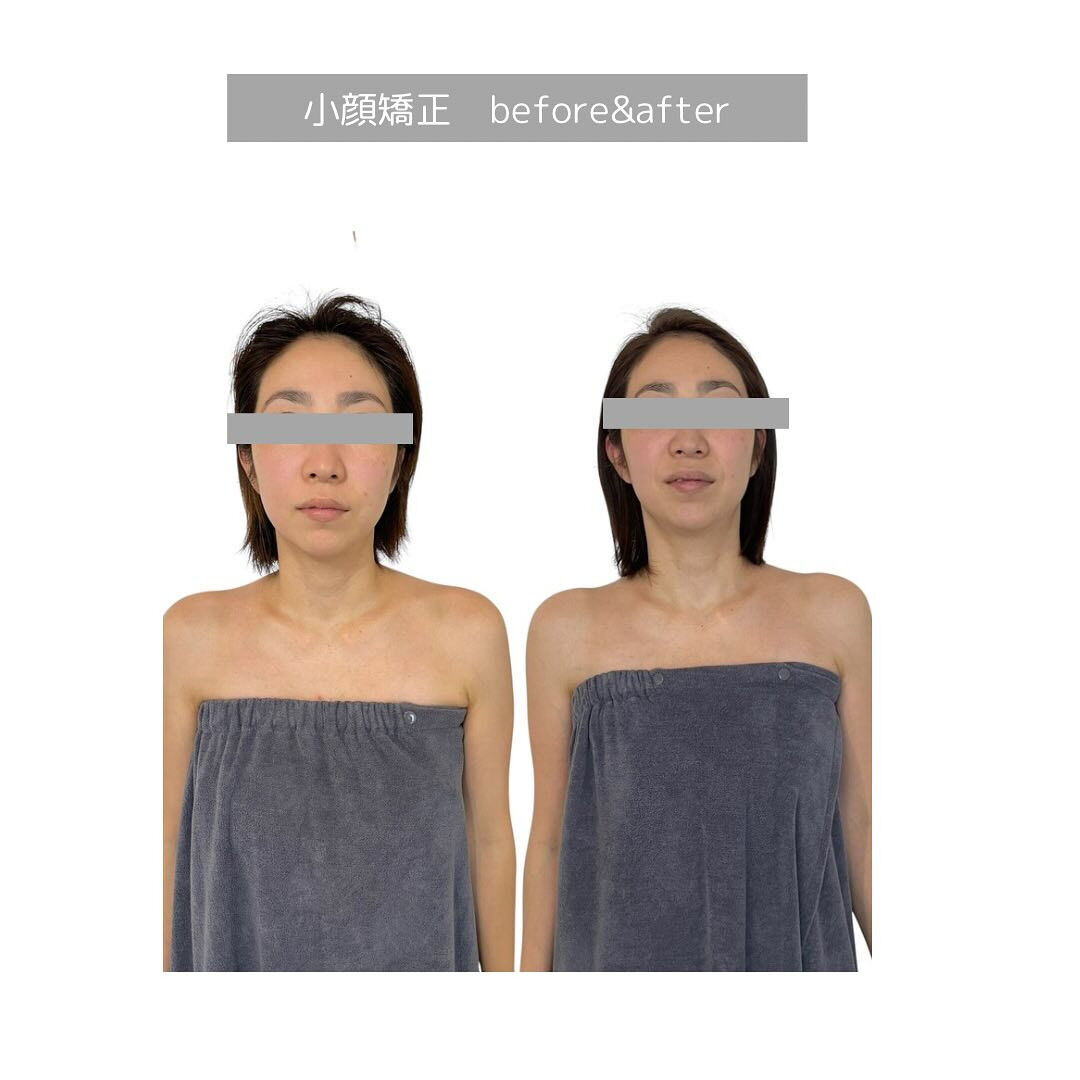 首、顔が前に出る！って