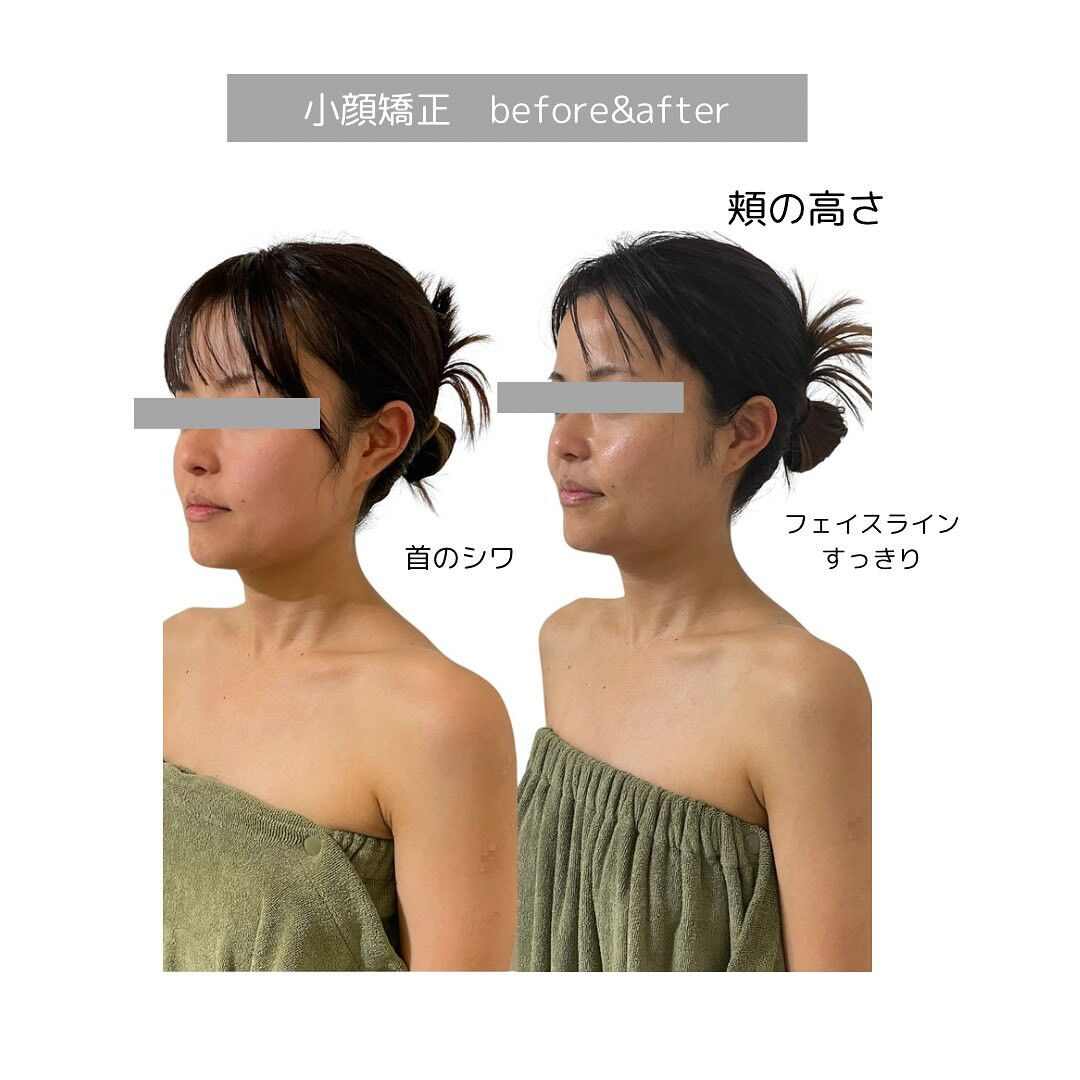 顔が前にでる！！