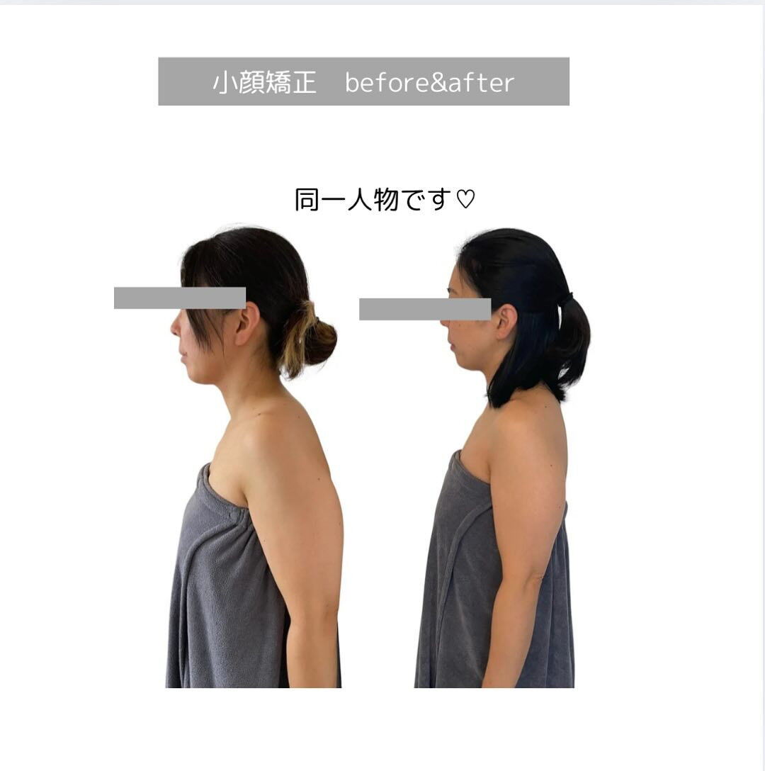 薄くなった♡♡