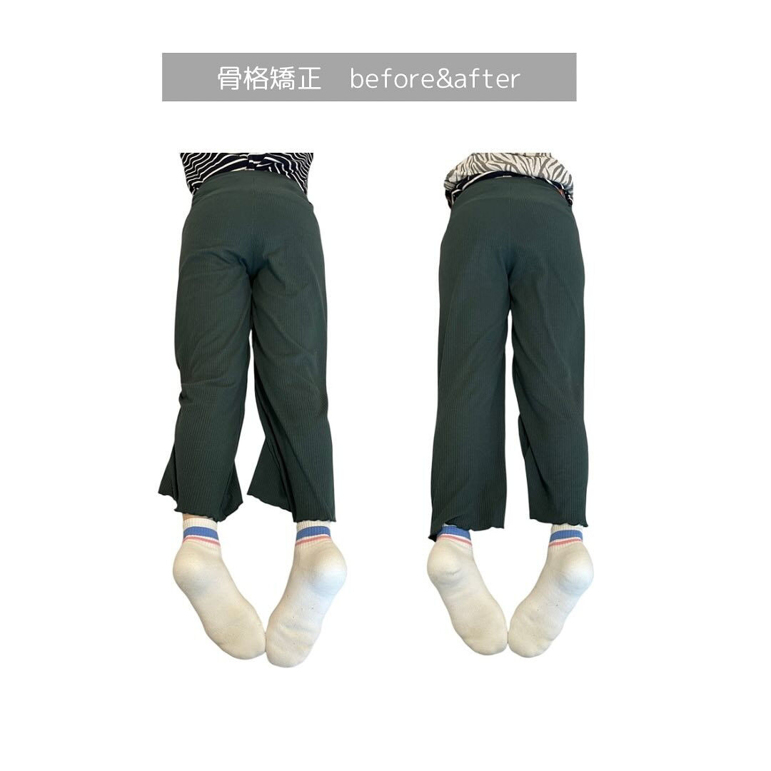 痛いですか？